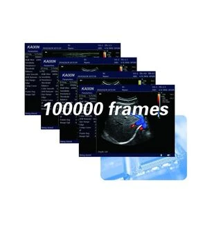 Ультразвуковой ветеринарный сканер Kaixin DCU12 с допплером